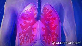 Winning the race to fight lung cancer? Medtech company with RTP lab says it can speed up biomarker test at lower costs