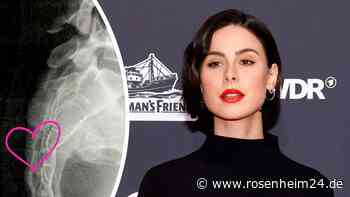 „Zwei Wirbel gebrochen“: Lena Meyer-Landrut hätte nach ihrem Reitunfall gelähmt sein können