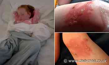 Britain's 'most dangerous plant' strikes again: Girl, 4, is left with painful burns up her legs after accidentally brushing past giant hogweed