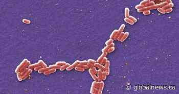 Alberta health minister, CMOH to provide update on Calgary E. coli daycare outbreak