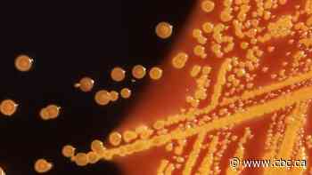 Alberta health minister, CMOH speak after hundreds of kids test positive for E. coli in Calgary