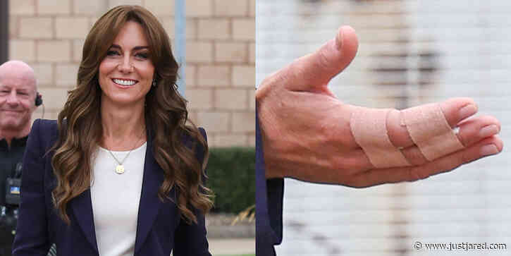 Here's How Princess Catherine Injured Her Fingers After Fans Notice Bandages During Royal Visit