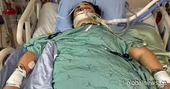 Family of Edmonton woman critically injured in hit and run calls for driver to turn themselves in