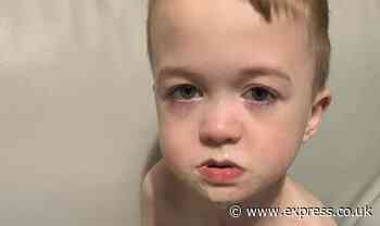 Mum’s plea as son’s weight drops to two stone after months of not keeping food down