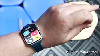 You can already use the Apple Watch's double-tap feature. Here's how