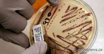 Calgary daycare E. coli outbreak brings supply chain, inspections into question