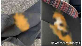 Shpalman a Roma, spuntano vecchie denunce. Il maniaco agisce da anni