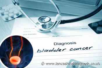 Bladder cancer symptom that people mistake for a UTI