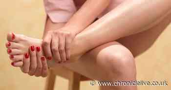 Tell-tale signs of a Victorian disease which is making a comeback across the UK