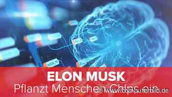 Elon Musk: Pflanzt Menschen Chips ein
