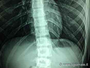 Lesione al midollo, nuova speranza dai topi che tornano a camminare