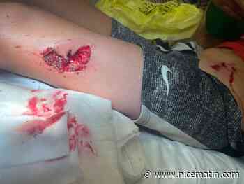 "Mon petit garçon est traumatisé": l'enfant de cette Antiboise a été mordu par un chien encore en liberté, elle exprime sa colère