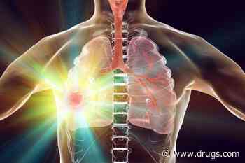 Combo Immunotherapy With Durvalumab Effective for NSCLC