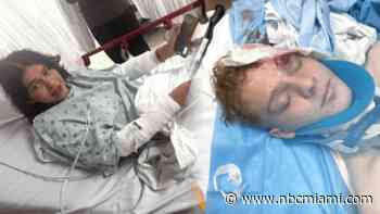 ‘Scared for my life': Teens hurt in Miami Beach hit-and-run speak as driver surrenders