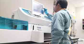 New Alberta ClarityDX prostate cancer blood test ‘groundbreaking’: developers