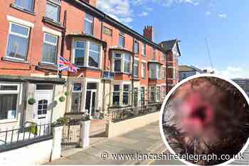 Police appeal after woman suffered serious head injury in Blackpool