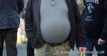 Government legislation needed to tackle 'challenge' of obesity, says public health boss