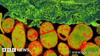 University of Warwick to share £18m in search for new antibiotics