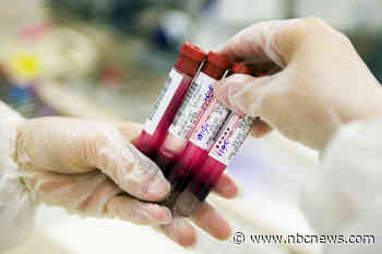 'Good' cholesterol levels may increase dementia risk