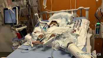 Burden of RSV falls mainly on youngest children, study finds, stressing need for better prevention