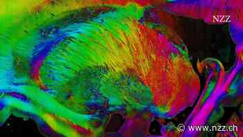 Zehn Jahre Human Brain Project: Das europäische Grossprojekt hat die Hirnforschung auf eine neue Stufe gehoben