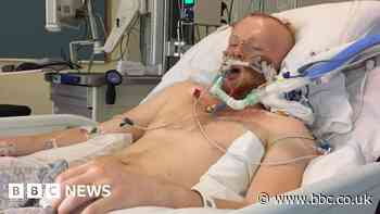 Hythe man tells others with brain injuries 'never lose hope'