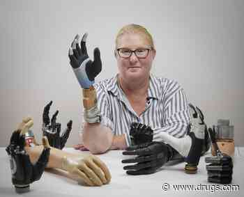 A Bionic Hand Melds With Woman's Own Bone, Nervous System