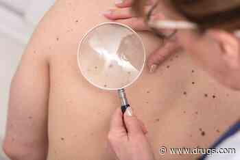 Latest AI Has 100% Success Rate in Spotting Melanomas