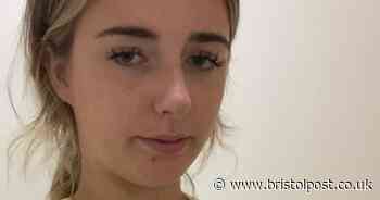 Symptoms of sepsis as woman ends up with deadly condition after trying to treat UTI with cranberry juice