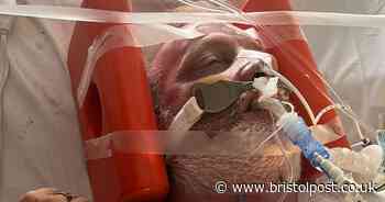 Man left fighting for life after 100ft escalator fall leaves him in coma