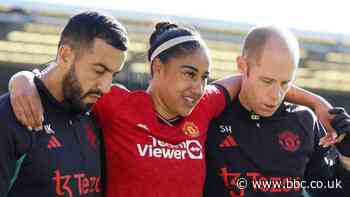 Manchester United defender Gabby George injures ACL and set to miss rest of season