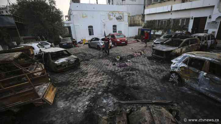 Gaza's doctors struggle to save hospital blast survivors as Middle East rage grows