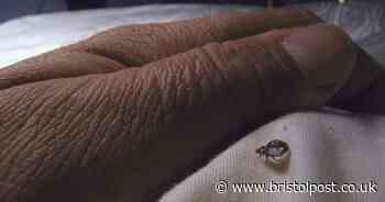 Hygiene expert shares plug socket warning amid bed bug outbreak crisis