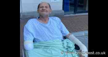 Pensioner attacked by dogs has left leg, right arm and left middle finger amputated