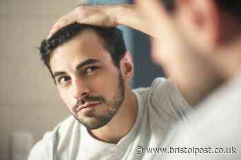 Researchers find new genes that could trigger baldness in men