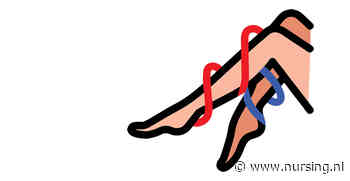 Arterieel of veneus ulcus: dit zijn de 6 belangrijkste verschillen (deel 2)