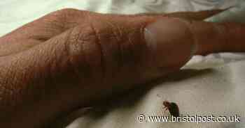 Stoke Gifford and Yatton revealed as bed bug hotspots on new map - check your area now