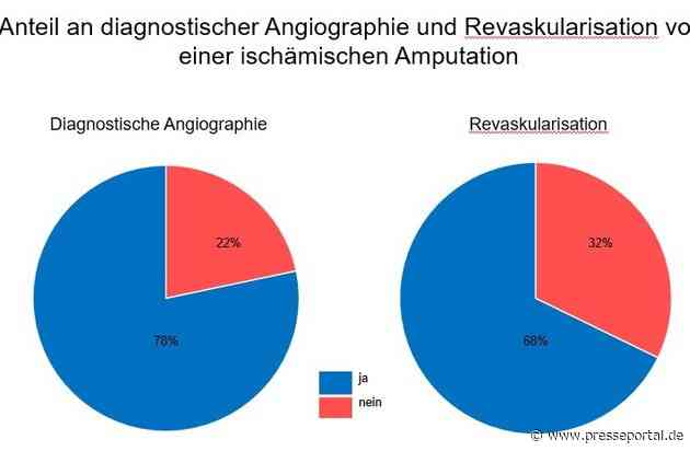 Viele Amputationen bei Patienten mit kritischer Ischämie könnten verhindert werden