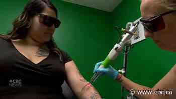 Organization that helps people leave gangs safely is offering free tattoo removal sessions