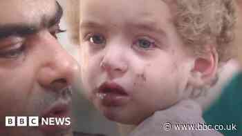 Cars race to Gaza hospital with injured children