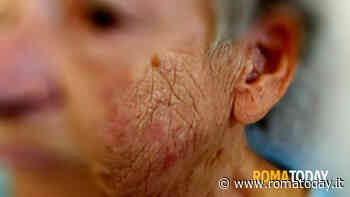 Anziana con il deambulatore aggredita in strada: "Colpita senza motivo"