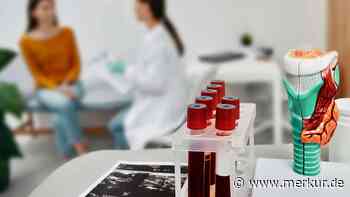 Schilddrüsenwerte nicht im Normbereich: Welche Erkrankungen dahinter stecken können