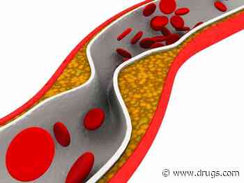 High Blood Triglycerides Could Help Ward Off Dementia