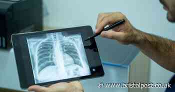 Mapped - the Victorian disease making a comeback across England cases near your home