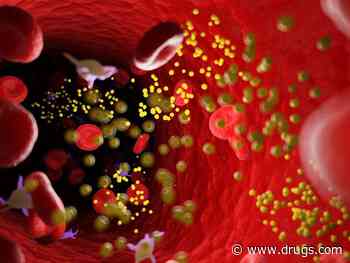 Higher Triglyceride Levels Linked to Lower Dementia Risk