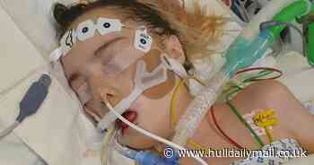 Hull boy, 17, with severe malnutrition ends up needing emergency liver transplant