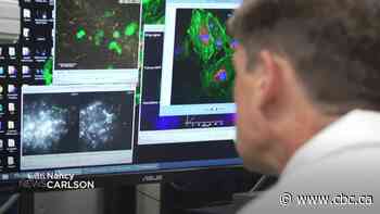 New non-invasive prostate cancer screening test offered in Alberta