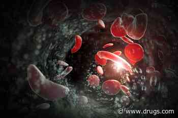 FDA Advisors to Weigh New Gene Therapy for Sickle Cell Anemia