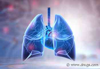 Plasma From Convalescent Donors Beneficial for COVID-19-Induced ARDS