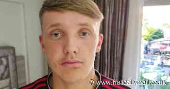 Man United fan left with broken jaw after rival footy fan spotted United tattoo and attacked him on family holiday